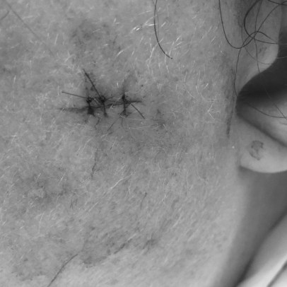 2016-08-20 21.54.17 BW